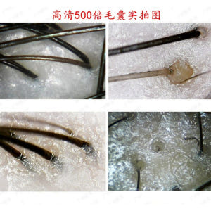 두피진단기 전자 현미경 모낭 모니터 카메라 개봉기 | 실사용 후기 - 상품 이미지 4