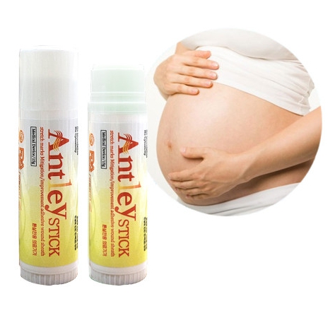 의료용 튼살 크림 스틱 오일 임신 출산후 청소년 임산부 안틀레이 급찐 살트임