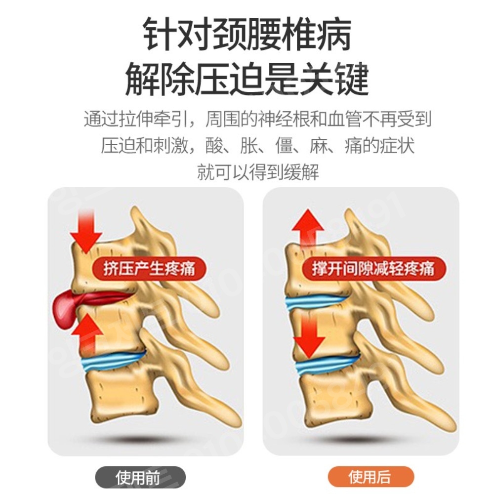 척추견인기 허리 측만증 자세 골반 교정기 필라테스 자세 - 상세 이미지 2