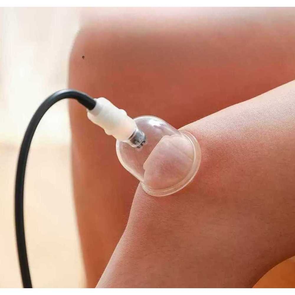 원터치 부항 전동 혈액 순환 병원 한의원 사혈 부황기 흡입 펌프 연결 세트 자동 마사지 부항컵 - 상품 이미지
