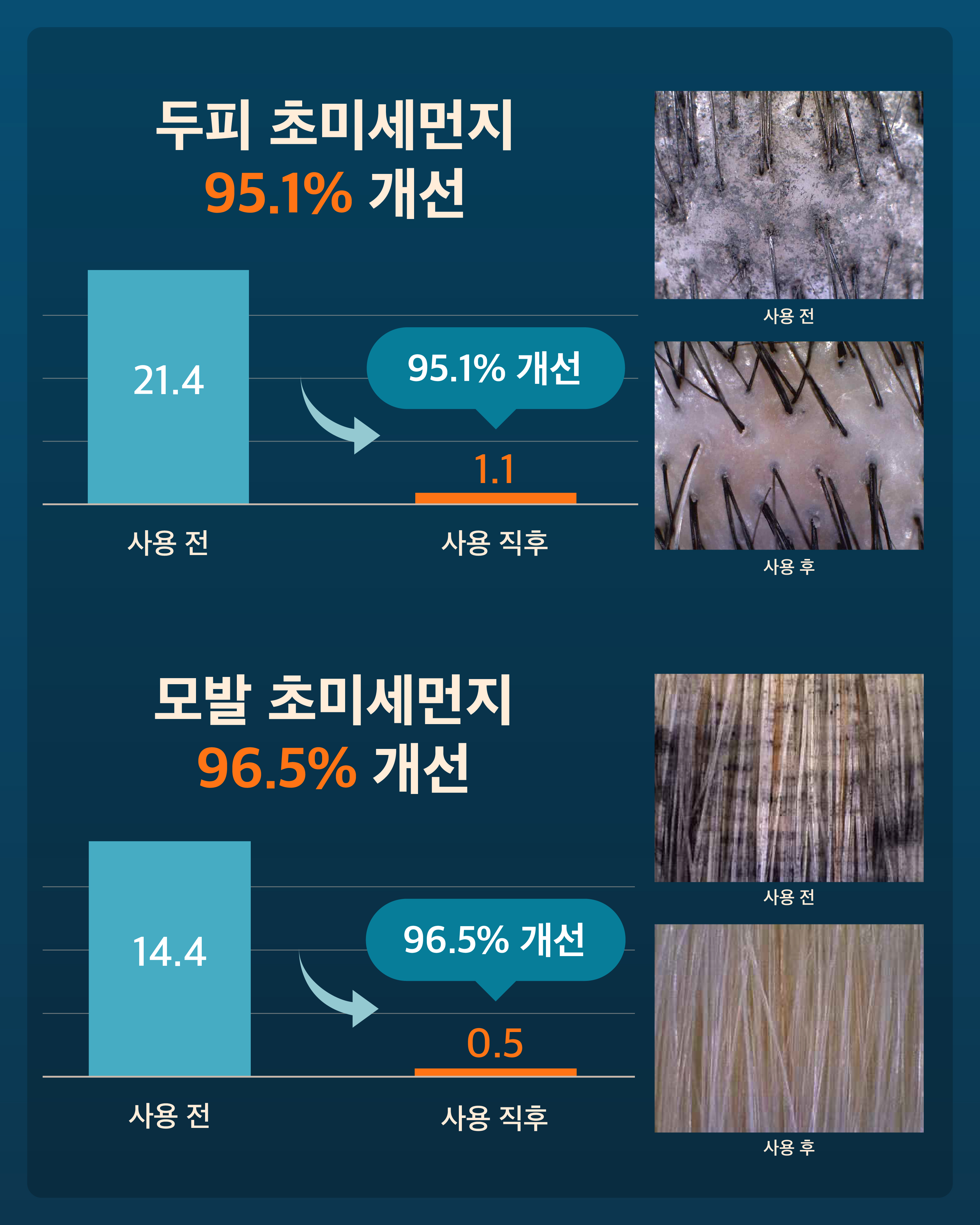 약산성 탈모샴푸 모제림 엘릭서 탈모샴푸 추천 탈모샴푸 사용후기 탈모샴푸 선택법
