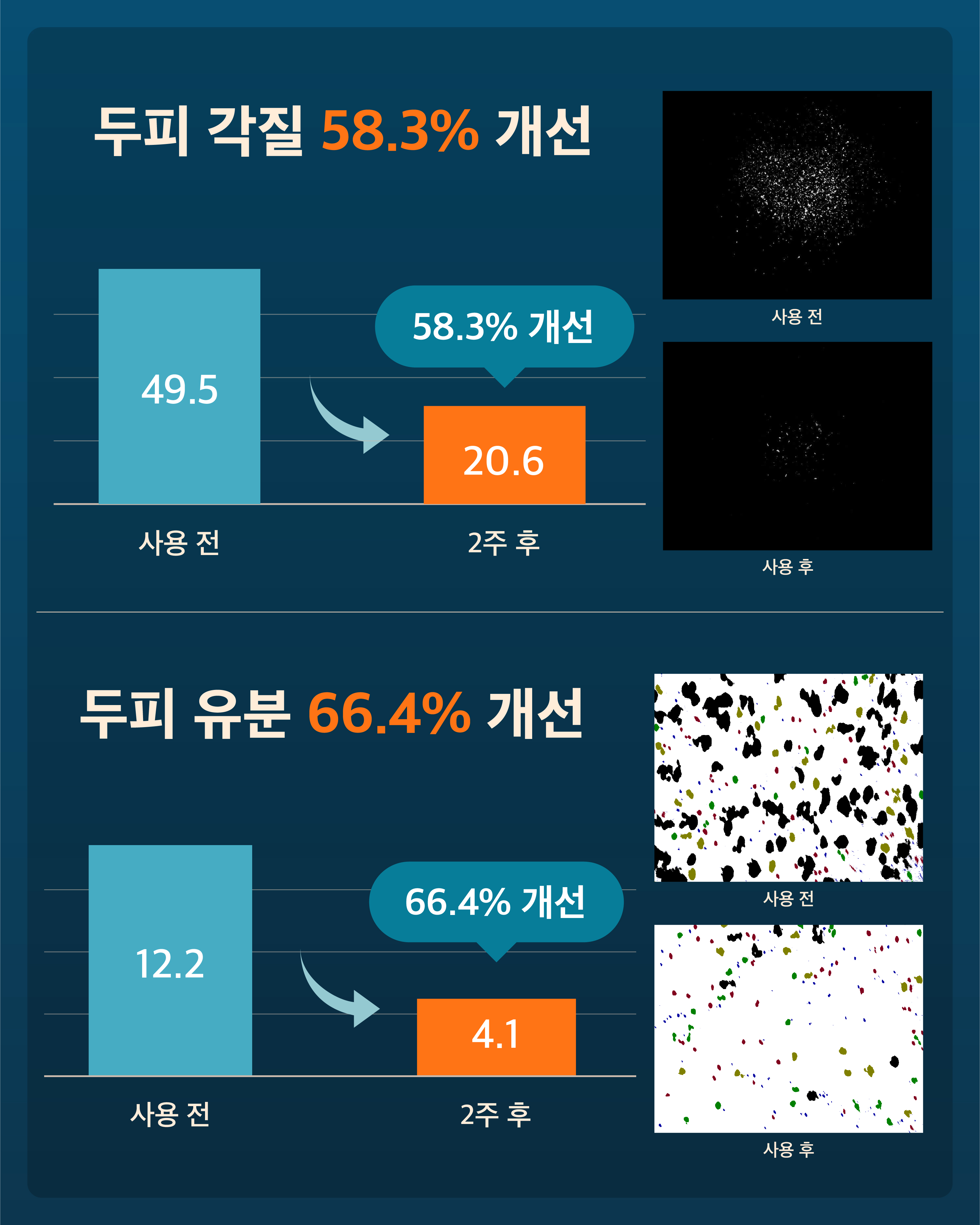 약산성 탈모샴푸 모제림 엘릭서 탈모샴푸 추천 탈모샴푸 사용후기 탈모샴푸 선택법