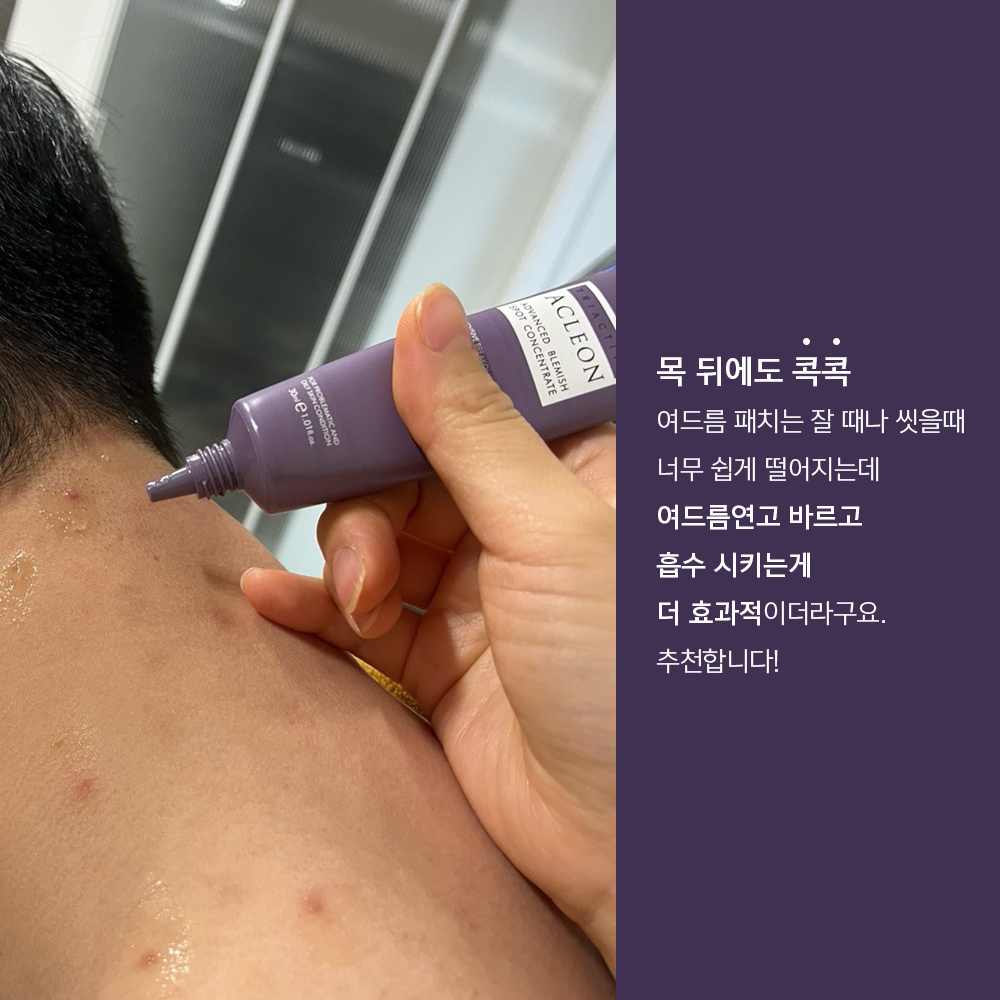 얼굴 요철 피부 트러블 아클레온 여드름 연고 사용법