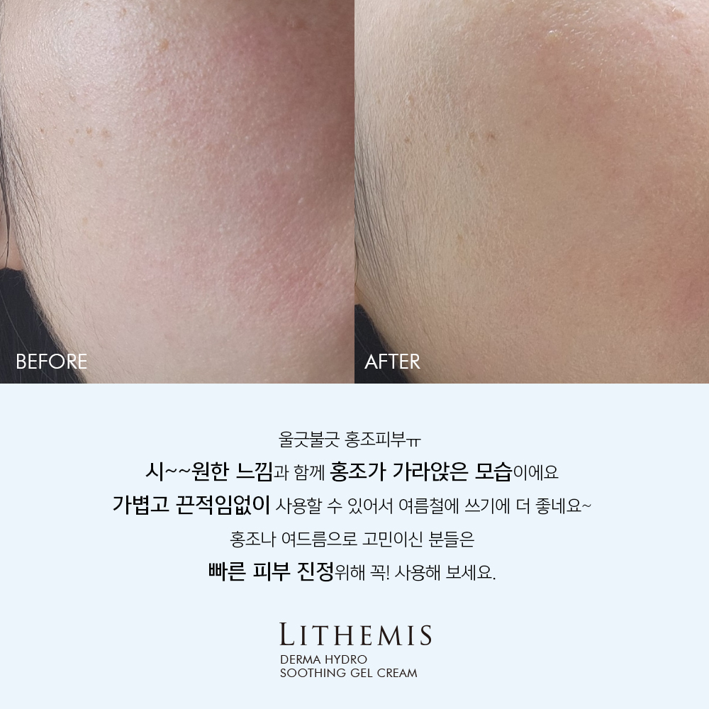 리더미스 하이드로 모공각화증 끈적임없는 지성피부 등드름 악건성 수부지 바디 로션 470g 이미지 8