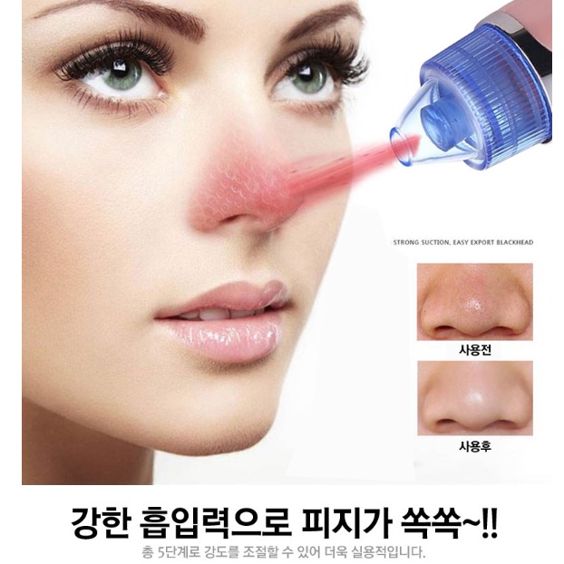 강력 전동 피지 흡착기 코 피지 흡입기 블랙 헤드 압출기 - 상세 이미지 3
