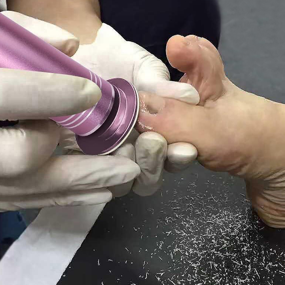 전동 발각질제거기 발 뒤꿈치 발바닥 굳은살제거
