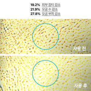 이니스프리 레티놀 시카 흔적 앰플 / 트러블 모공 색소침착 저자극 50m... 솔직 후기 | 피부 타입별 분석 - 상품 이미지 3