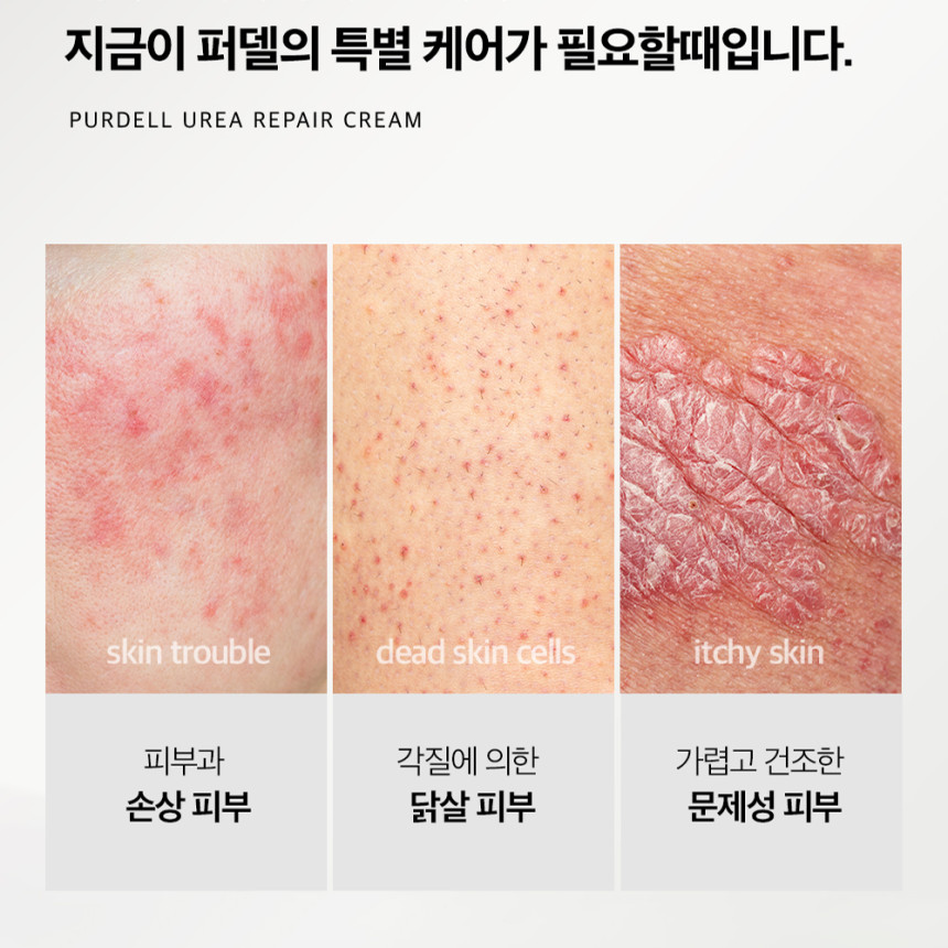 더마퍼델 우레아 70000ppm EGF 리페어 크림 퍼델 병풀 시카 레이저 피부진정 7% 사진 3