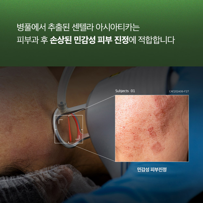더마퍼델 우레아 70000ppm EGF 리페어 크림 퍼델 병풀 시카 레이저 피부진정 7% 사진 5