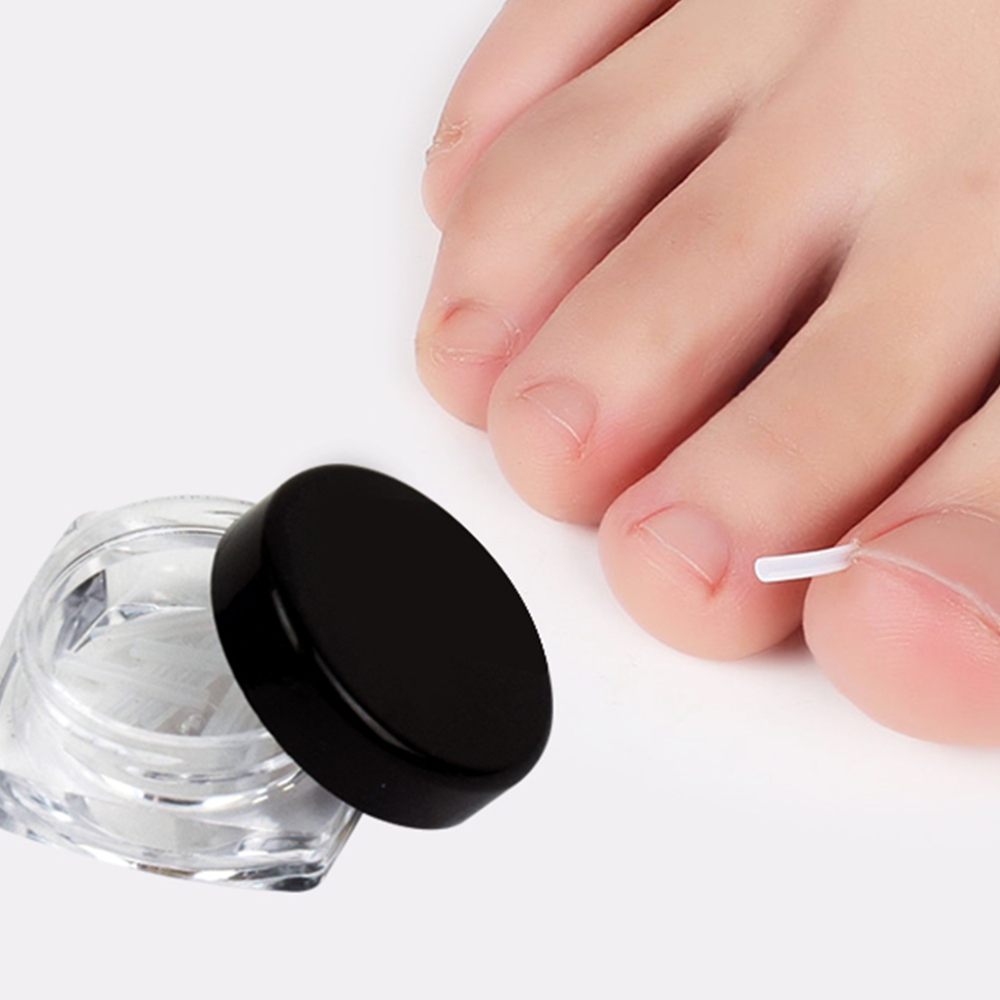 변형발톱 교정기 내성발톱 벌리기 자가치료 와이어 10p