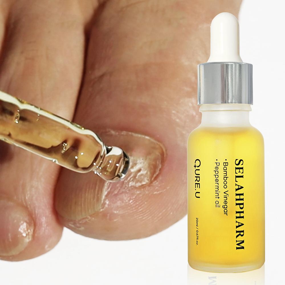 큐어유 셀라팜 20ml 문제성 발톱 집중 큐어 솔루션 리얼 앰플 발냄새제거 - 상품 이미지
