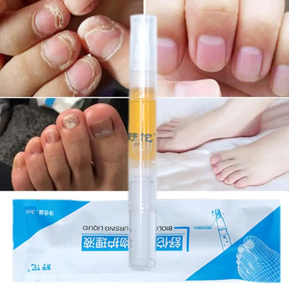 롤러 마사지 하이엔드 네일 케어 펜 발톱 수리 천연 성분 뷰티 건강 리페어 에센스 도구 : 추추컴퍼니