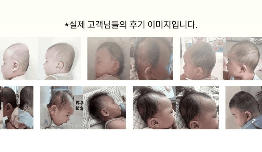 아이누오 피트 쿨쿨 아기베개 신생아 유아 태열 두상 출산선물 짱구베개 두상 관리 판매처 상세 정보 이미지 4