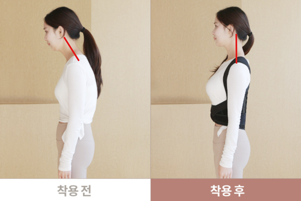 메디인포 자세교정밴드 거북목 일자목 라운드숄더 목디스크 굽은등 개선 바른자세교정밴드 상품 이미지