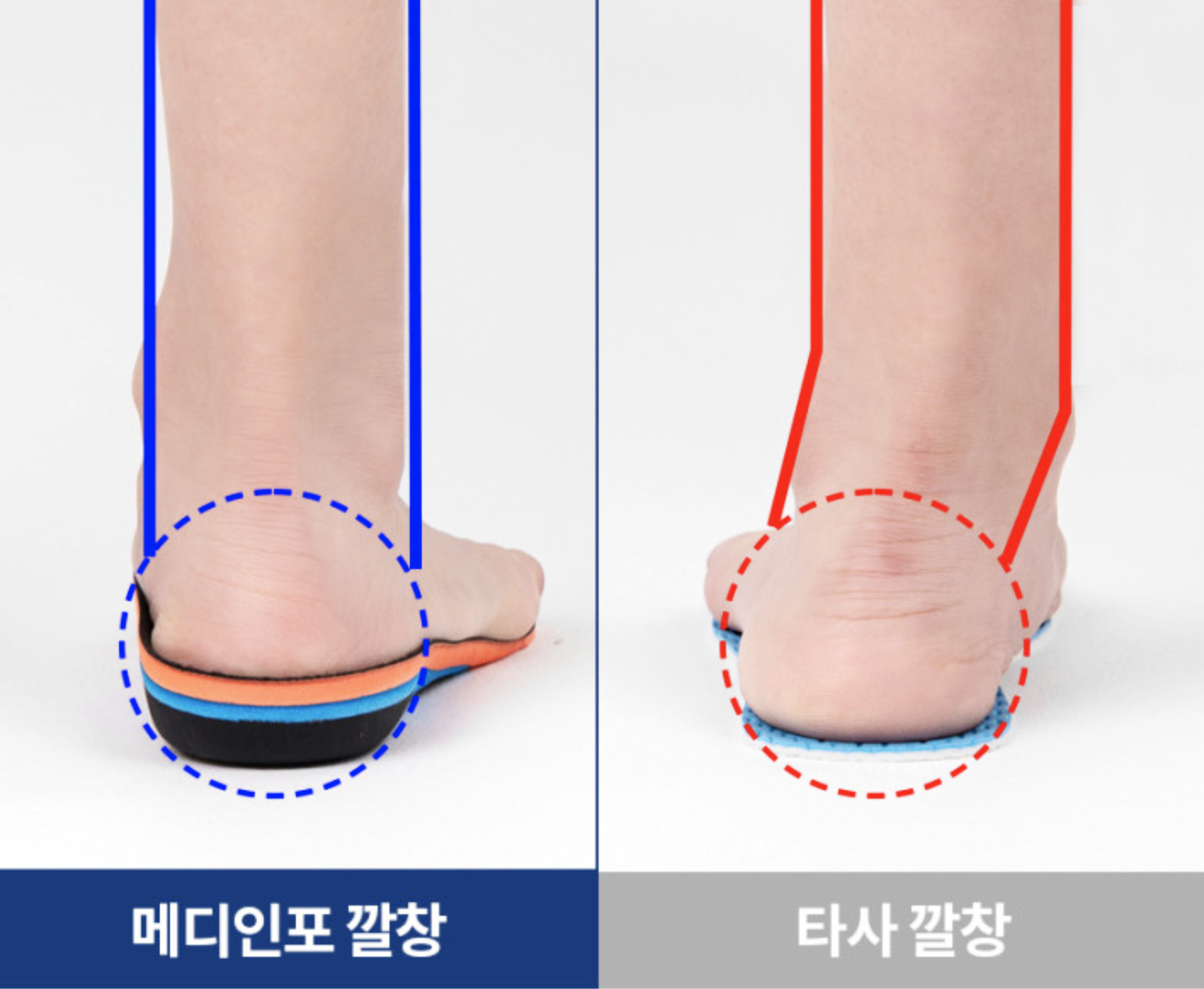 메디인포 아치리프트 30/5 족저근막염 증상 평발 아치 운동화 등산화 안전화 군대 군화깔창 상품 이미지