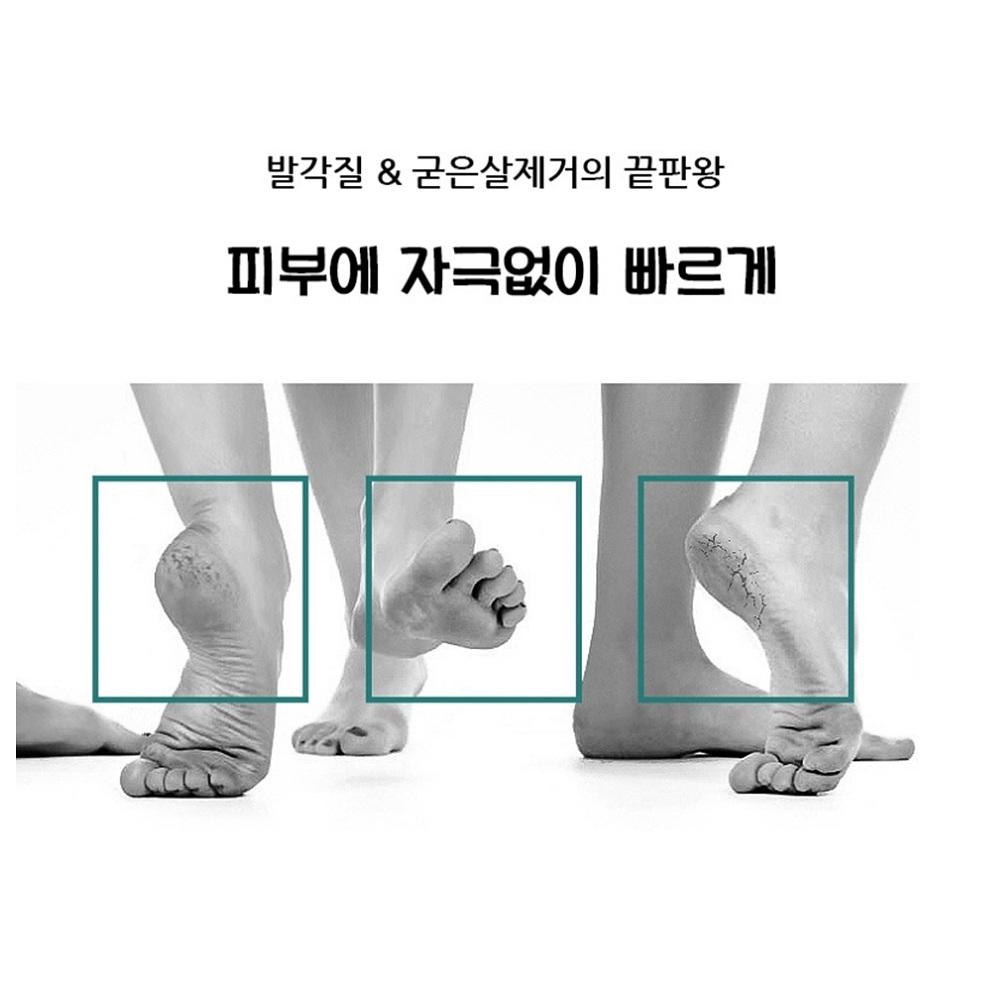 티눈제거칼 발바닥 굳은살제거칼 손가락굳은살제거