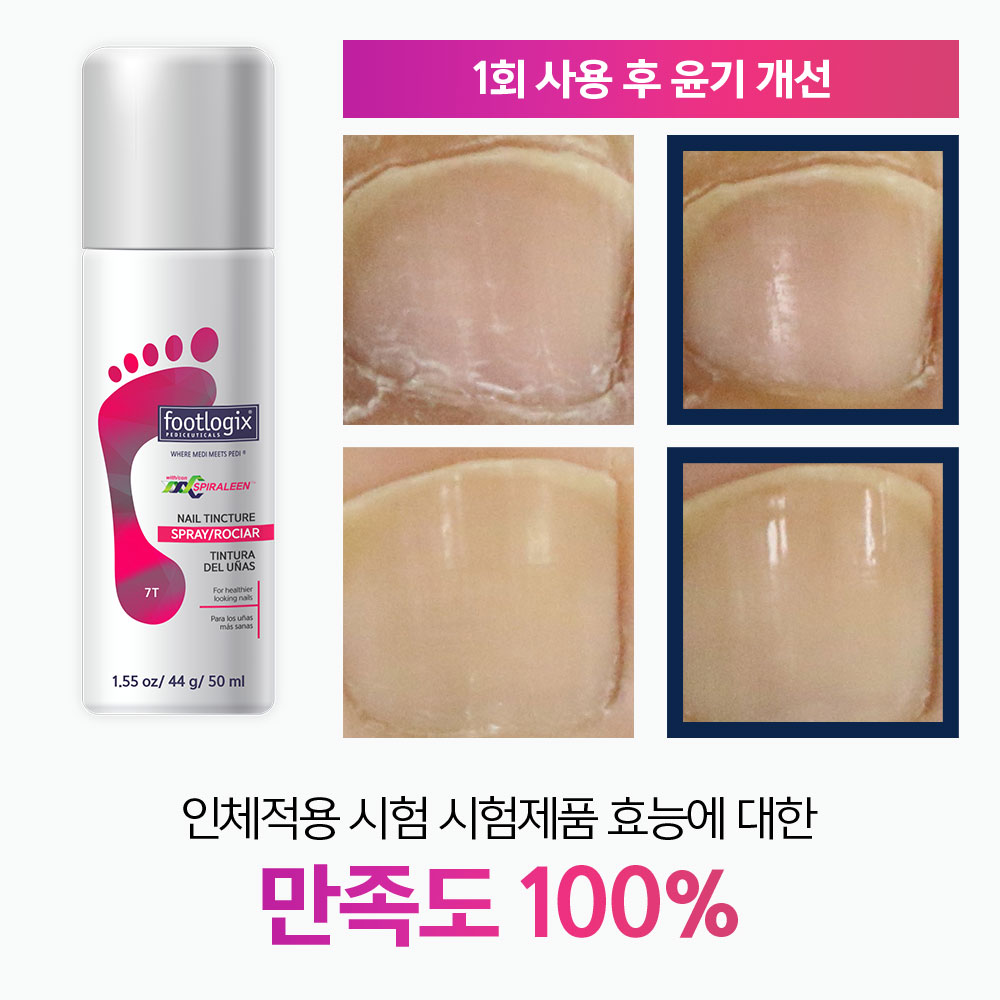 풋로직스 발톱케어 스프레이 50mL+발각질제거기 - 상세 이미지 4