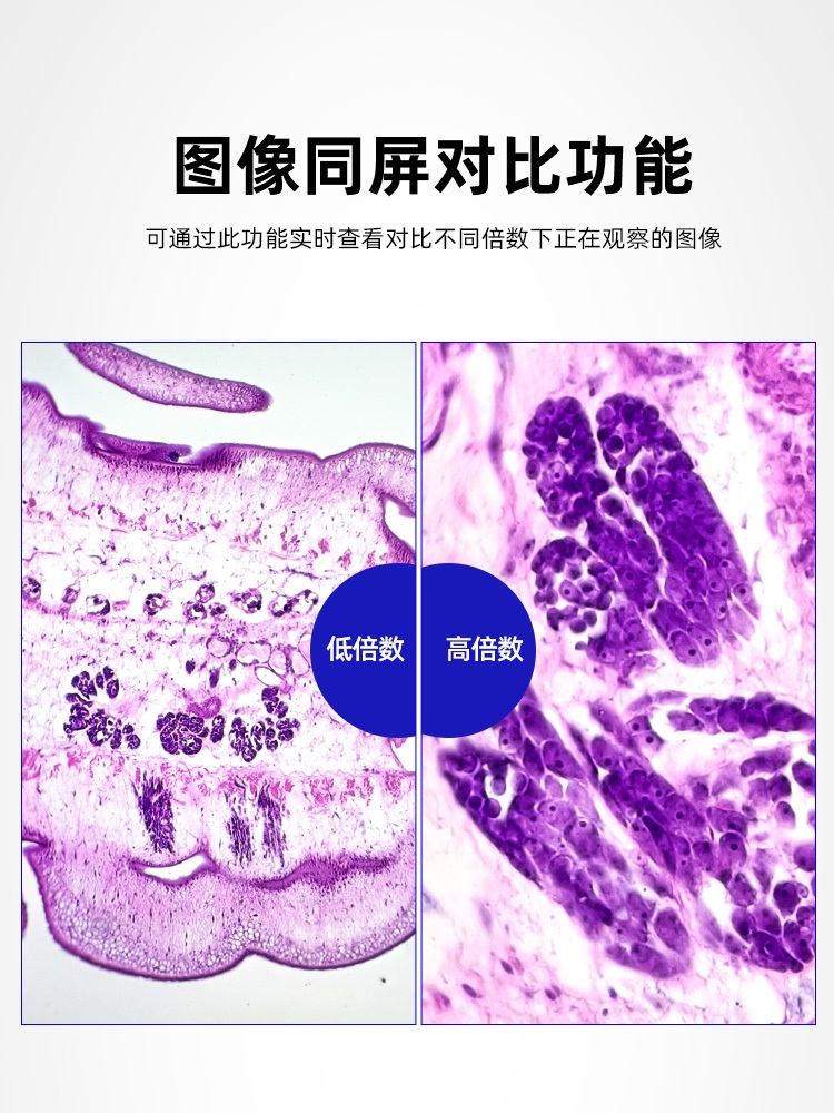고배율 생체광학 현미경 세균 장비 검사 분석기 손가락 105- 단안 195 HD - 상세 이미지 3