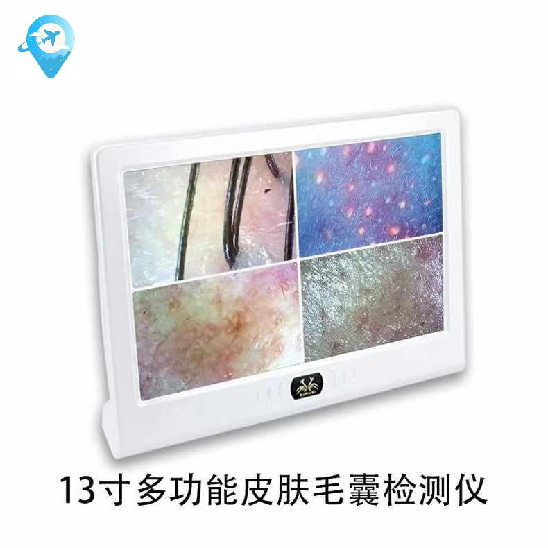 두피진단기 스캐너 인치모니터 두피현미경 두피카메라 - 상세 이미지 3