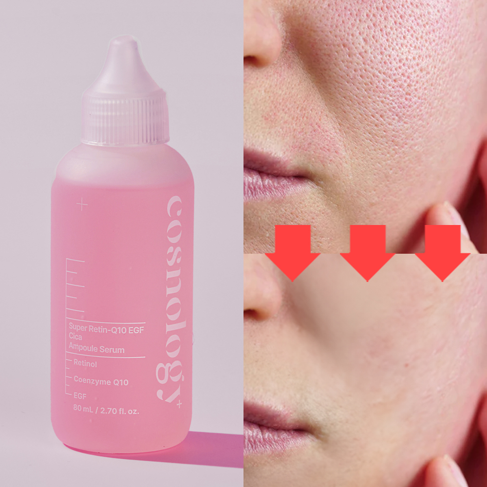 코스놀로지 핑크샷X4 EGF 레티놀 줄기세포배양액 모공수축 탄력 모공앰플 80ml, 1개 이미지 4