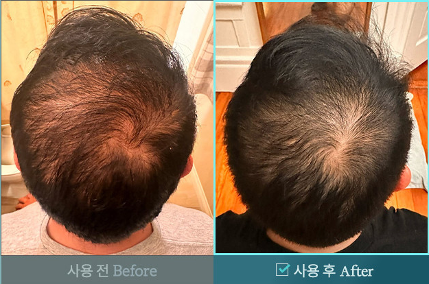 [행사상품] 벤스랩 비엘모 두피토너 대용량 120ml, 3+1 행사(탈모완화 기능성)