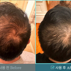 [행사상품] 벤스랩 비엘모 두피토너 대용량 120ml, 3+1 행사(탈모... 솔직 후기 | 피부 타입별 분석 - 상품 이미지 3