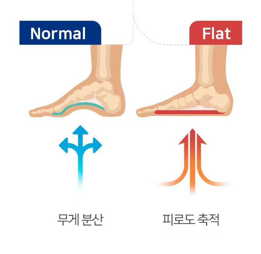 발아치 실내화 기능성 슬리퍼 여성 아치 실내화 커브 이미지 8
