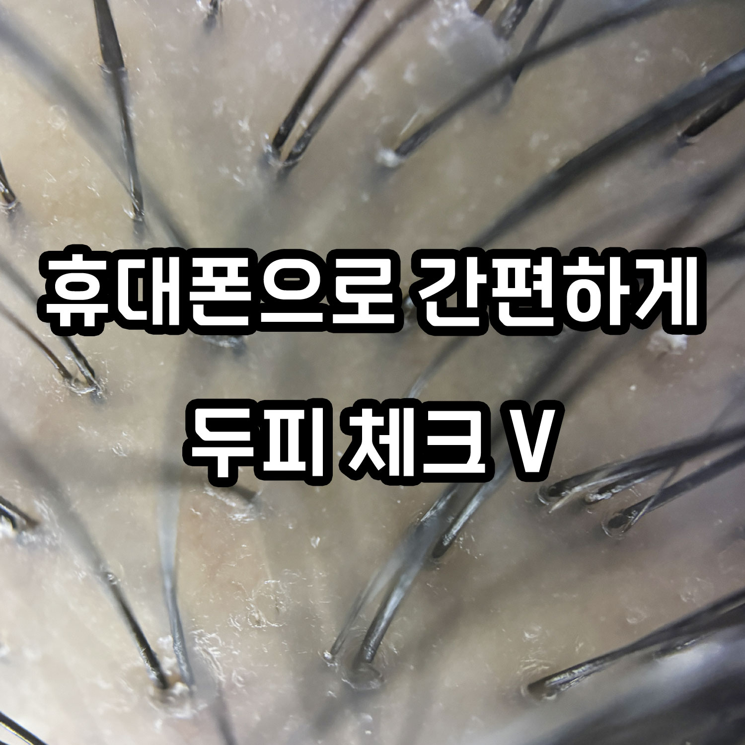 APEXEL 휴대용 현미경 200배율 접사 두피 모발 확대경 LED 탑재 디지털 고배율 - 상세 이미지 3