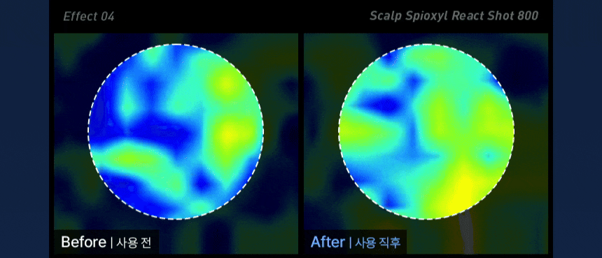 VIVELAB Scalp Spioxyl React Shot 800 - description 13