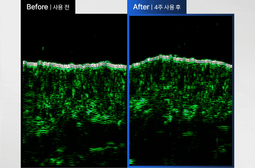 VIVELAB Scalp Spioxyl React Shot 800 - description 15