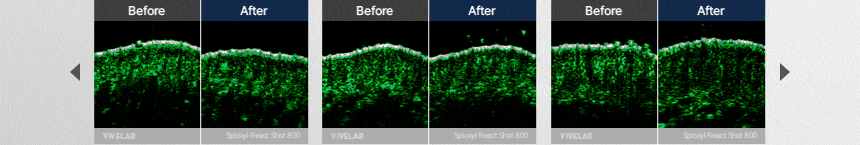 VIVELAB Scalp Spioxyl React Shot 800 - description 17