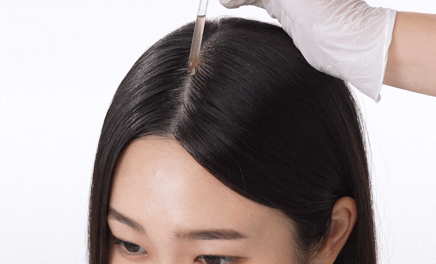 VIVELAB Scalp Spioxyl React Shot 800 - description 5
