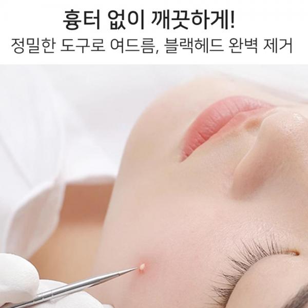프라임픽 압출기 세트 피지 제거기 도구 압출핀셋 블랙헤드 코 : -프라임픽