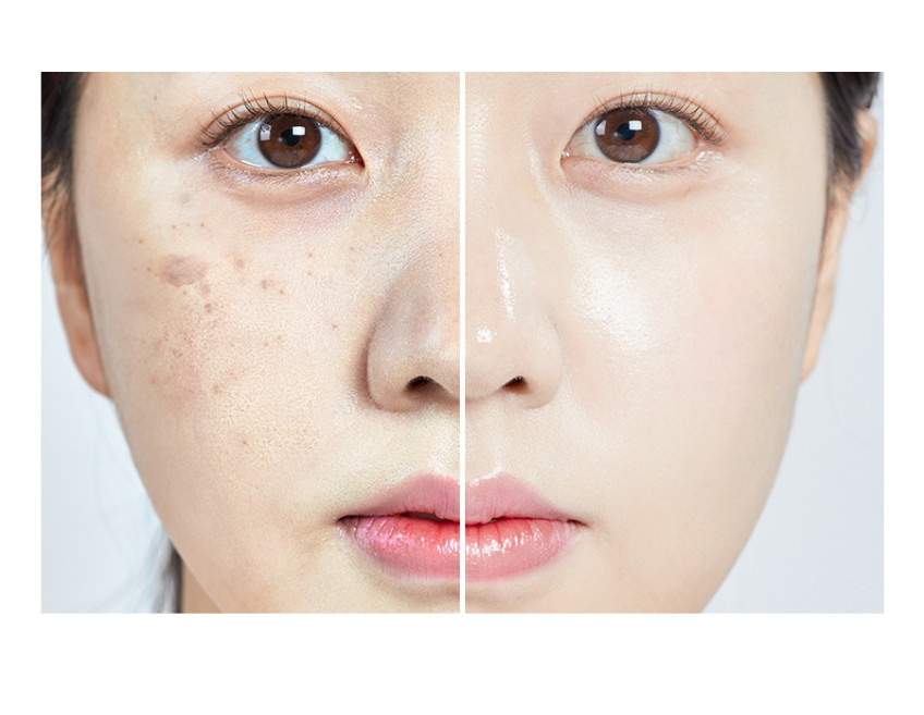 메디필 멜라논 엑스 크림 트라넥삼산 30ml, 2개