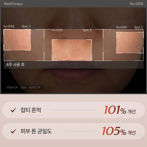 thumbnail-4