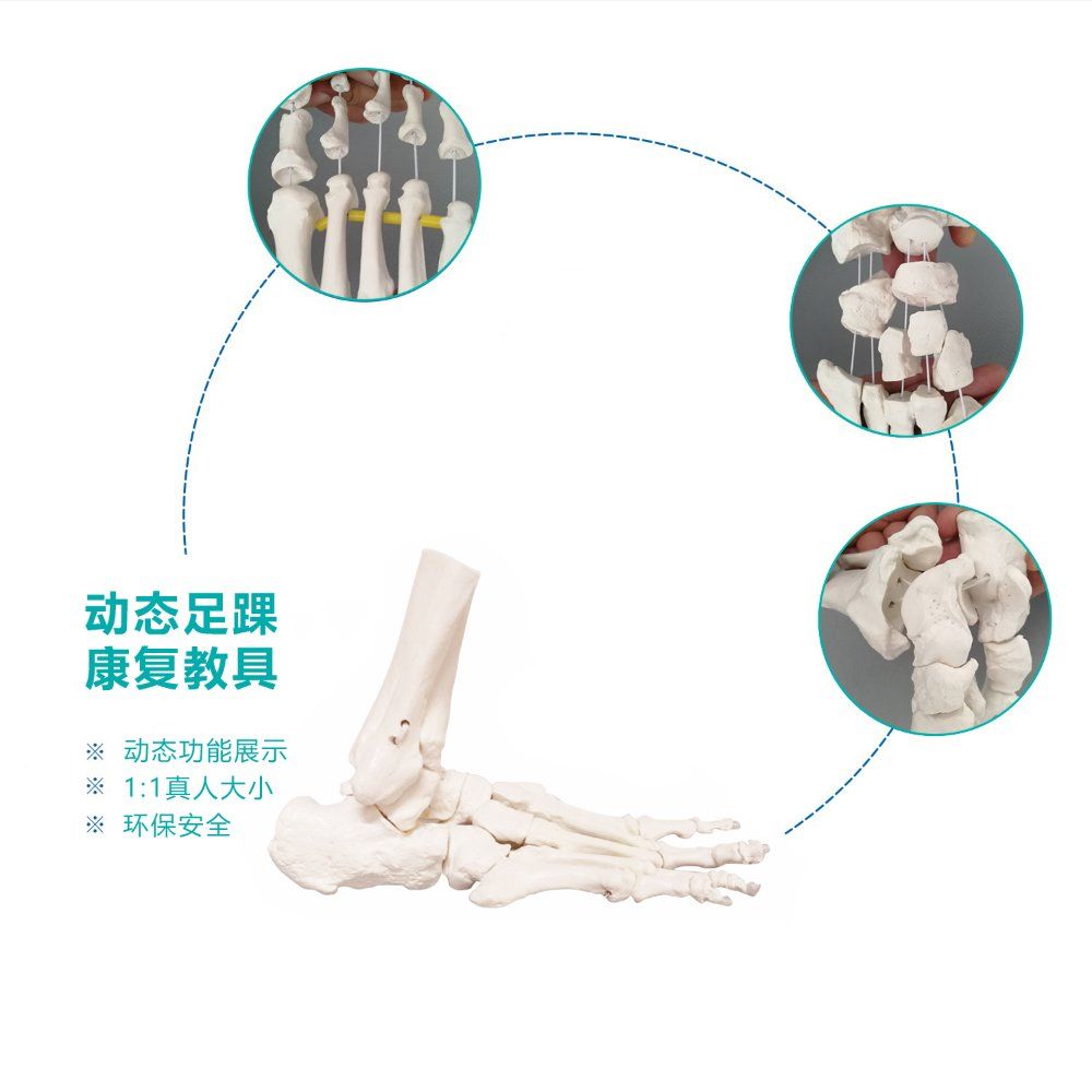발 발뼈 관절 뼈 인대 발목 교육 인체 의학 모형 교구 정형외과 과학 병원 - 상세 이미지 3