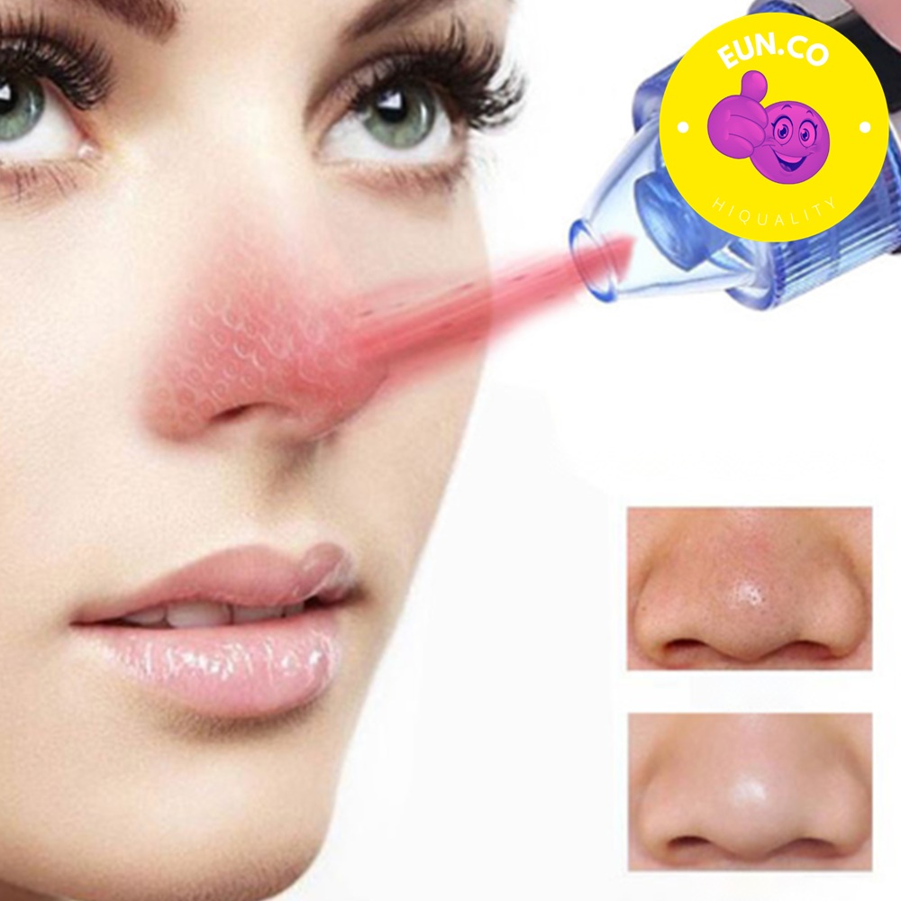 코 피지제거기 딸기코 블렉헤드 제거 없애기 - 상품 이미지