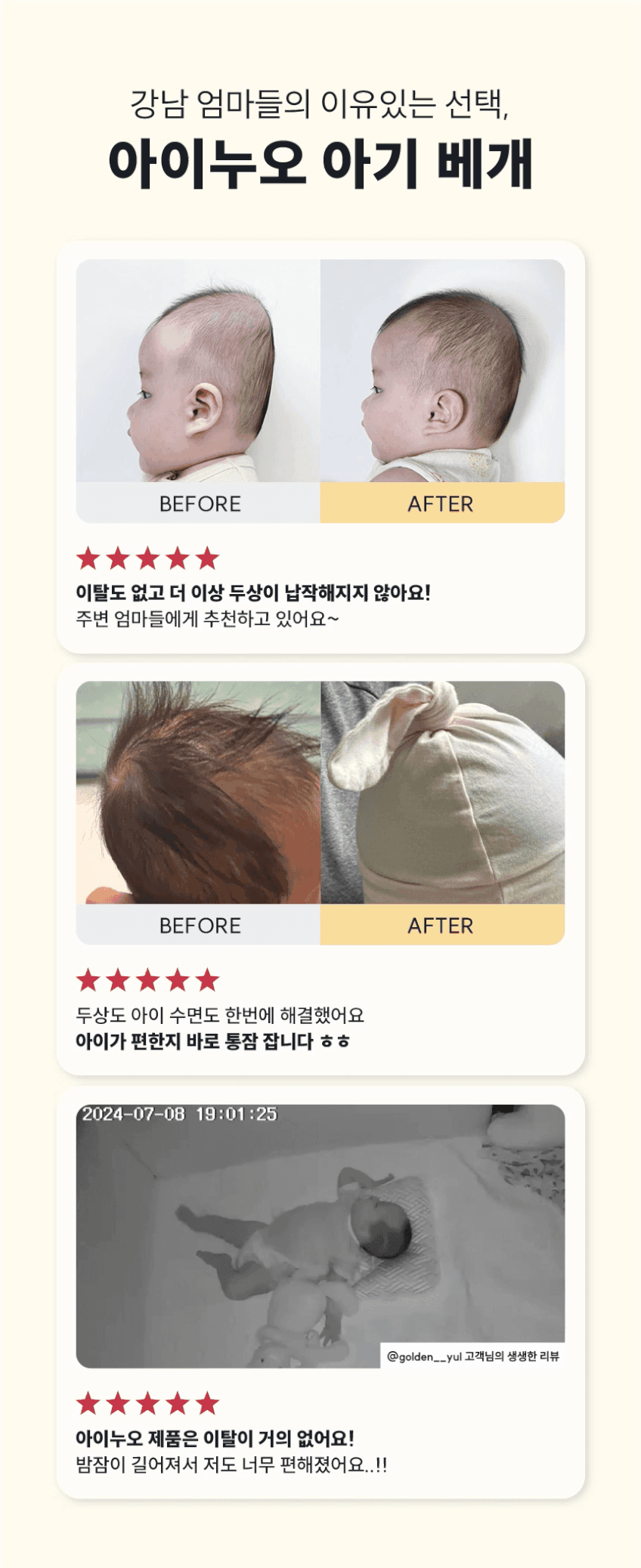 아이누오 피트 오가닉 아기 베개 신상아 짱구 두상 관리 출산 선물 단두증 사두증 판매처 상세 정보 이미지 4