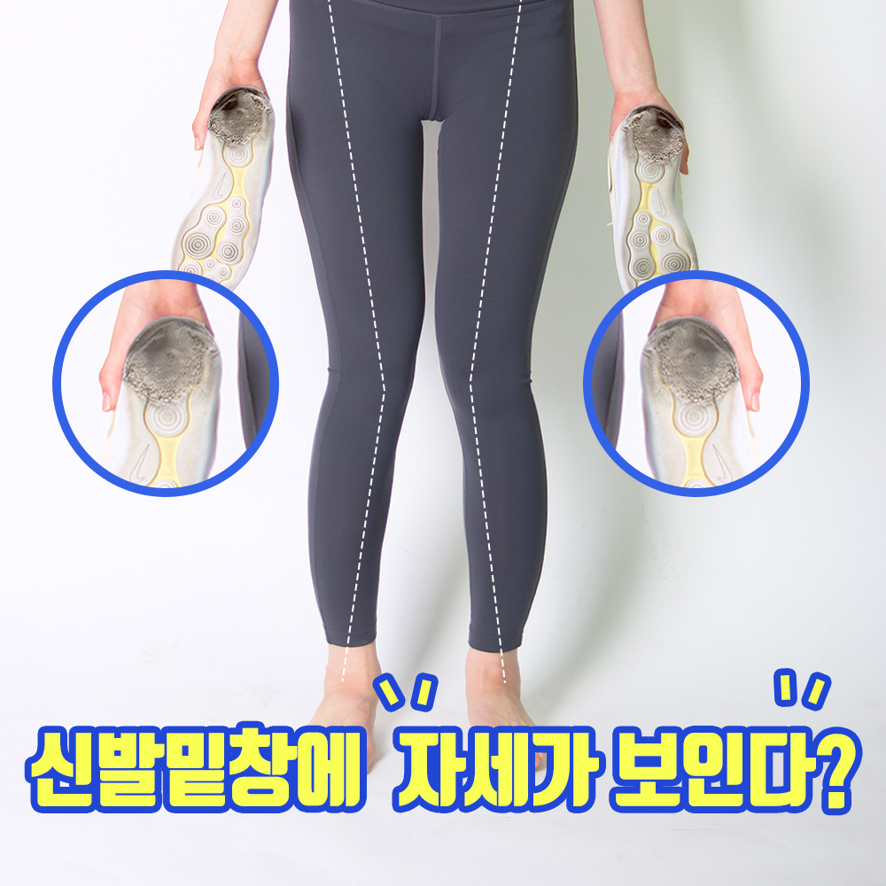 핀처 팔자 걸음걸이 오다리 깔창 족저근막염 뒷꿈치 워크패드 이미지 2