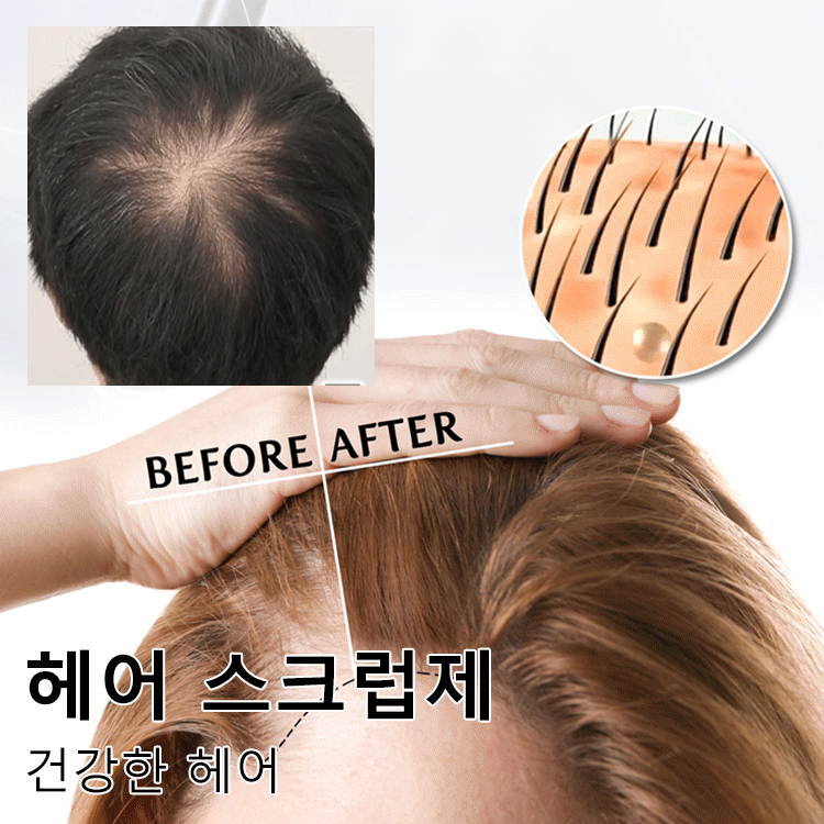 탈모 방지 및 발모 헤어 스크럽제 거스러기 제거 가려움증 완화 두피스크럽 : 컬러풀 타운