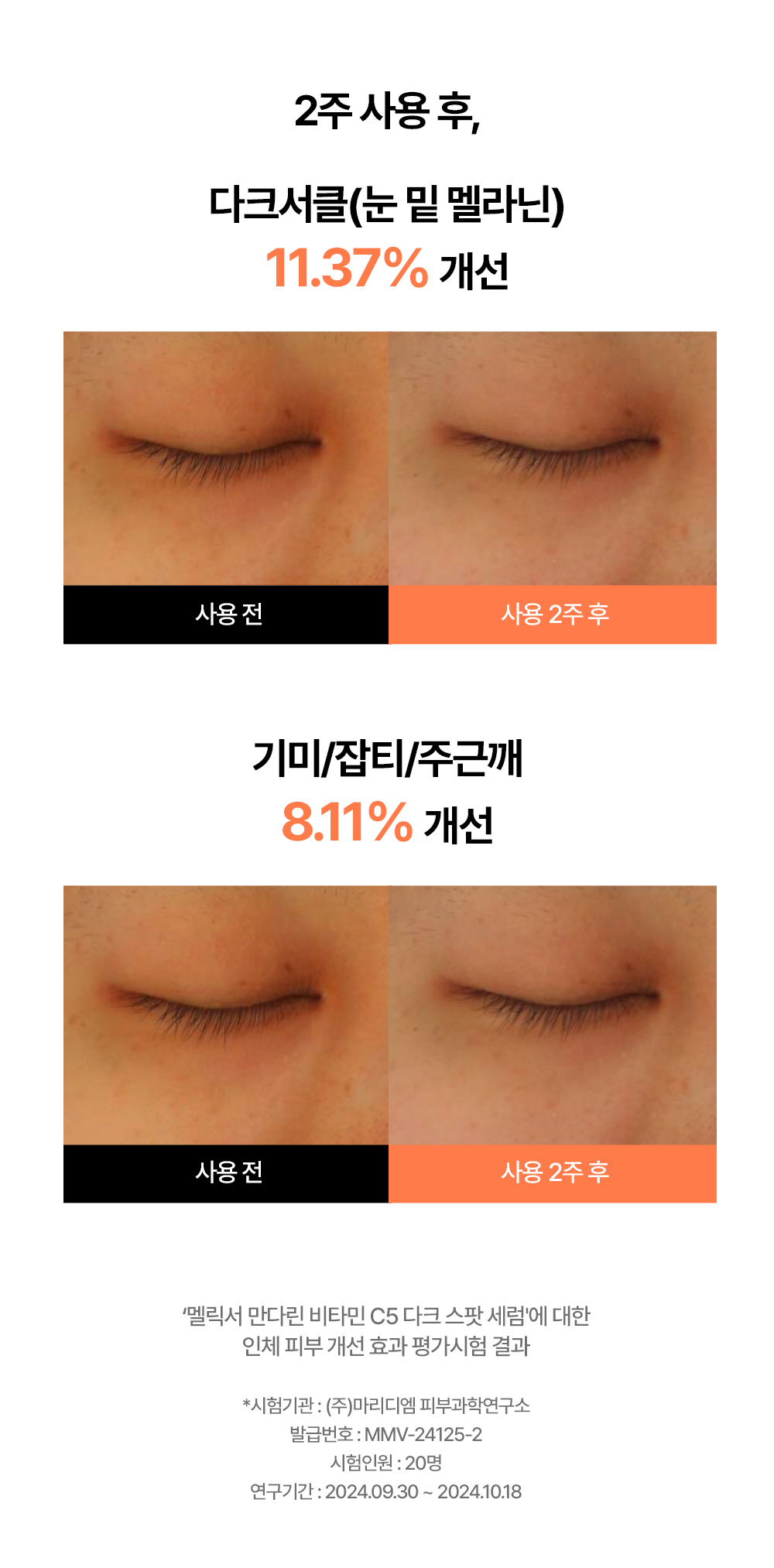 melixir vitamin c5 dark spot serum korean duo