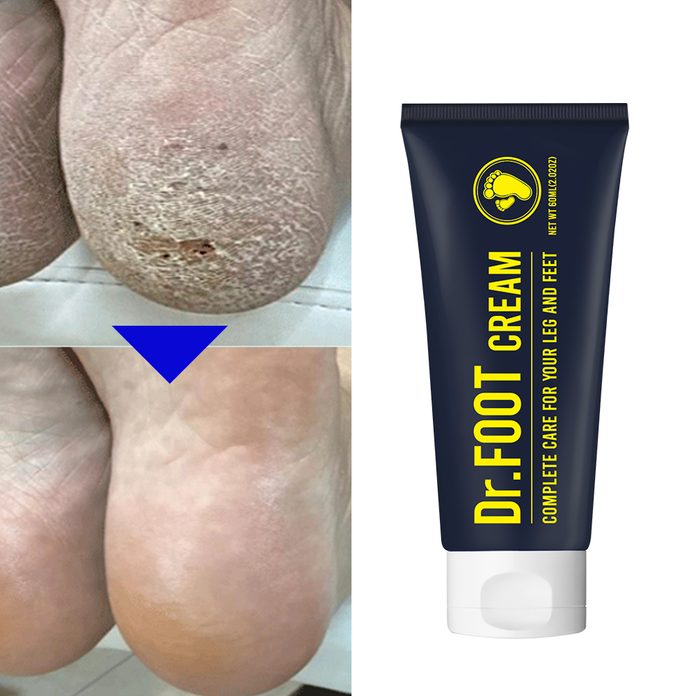 닥터풋 발 냄새 뒤꿈치 굳은살 각질 제거 연화 갈라짐 보습 풋 케어 크림 60ml, 1개 - 상세 이미지 4