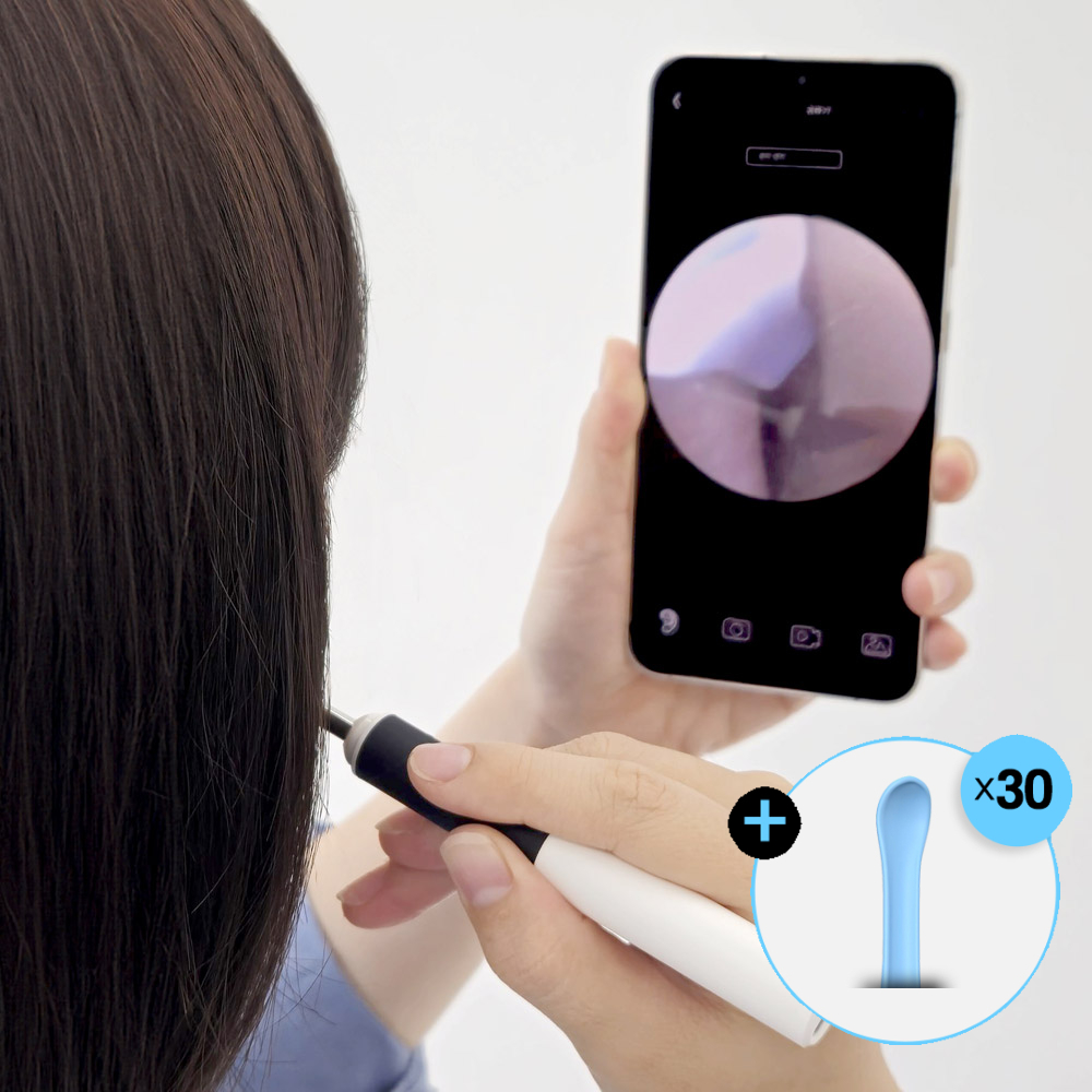 이어뷰 귀내시경 귀이개 귀파개 청소 귀지 제거 1000만화소 카메라 제품 이미지