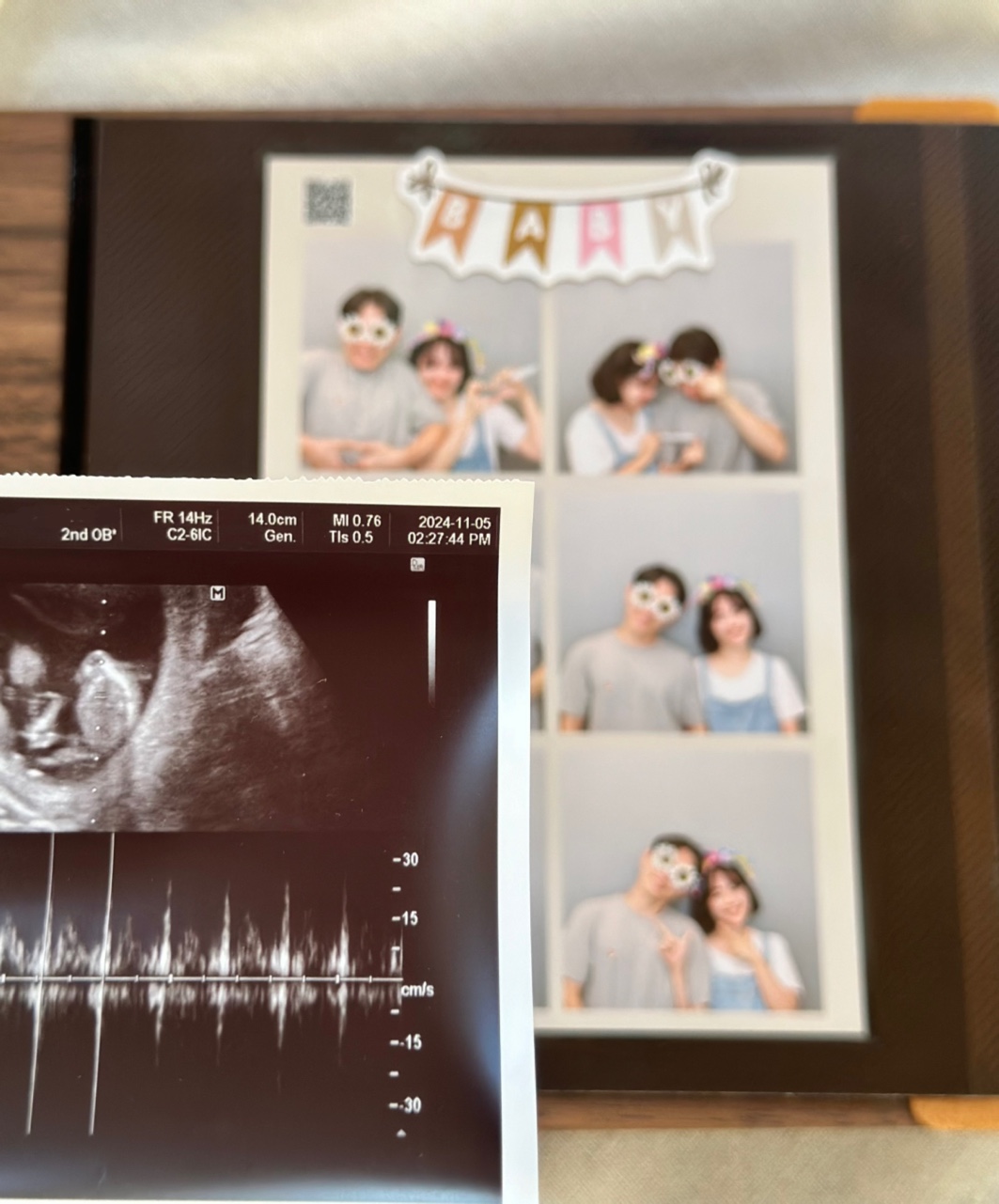 아가모아 초음파 앨범 사진 꾸미기 보관 셀프포토북 접착식 이미지 4