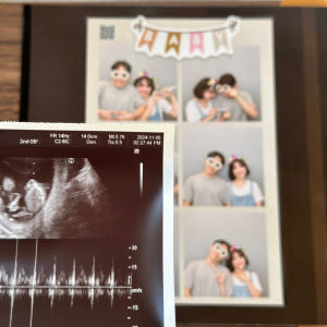 아가모아 초음파 앨범 사진 꾸미기 보관 셀프포토북 접착식 실사용 후기 | 효과 있을까? - 상품 이미지 4