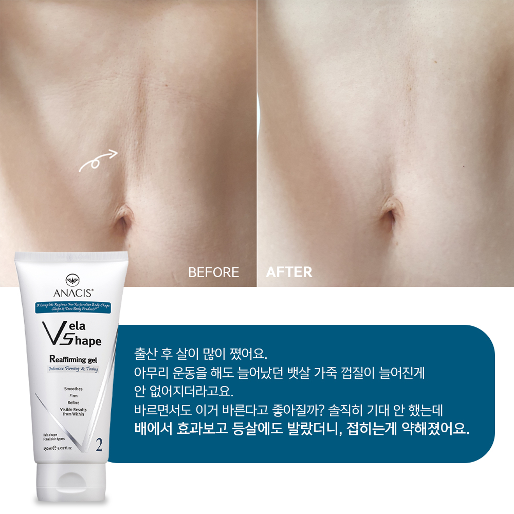 벨라쉐이프 리어퍼밍 바디쉐이핑 몸매 울퉁불퉁 바디 라인 엉덩이 탄력 처진 가슴 크림 - 상세 이미지 2