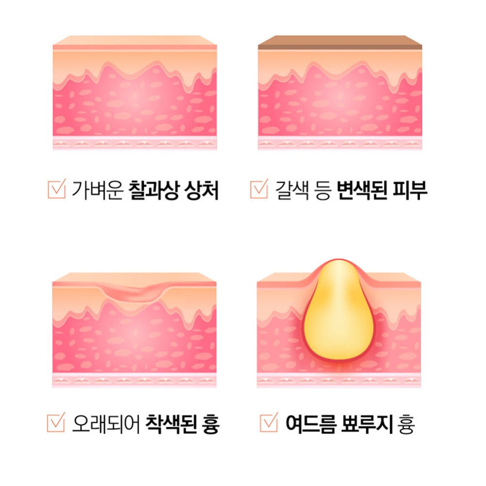 재생연고 피부과재생크림 색소침착연고 여드름흉터 이미지 6