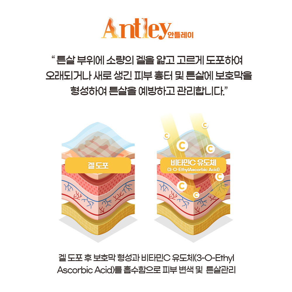 pH4 피에이치포 의료기기 안틀레이 겔+스틱+시트 튼살 관리 의료기기 3종 세트 - 상세 이미지 5