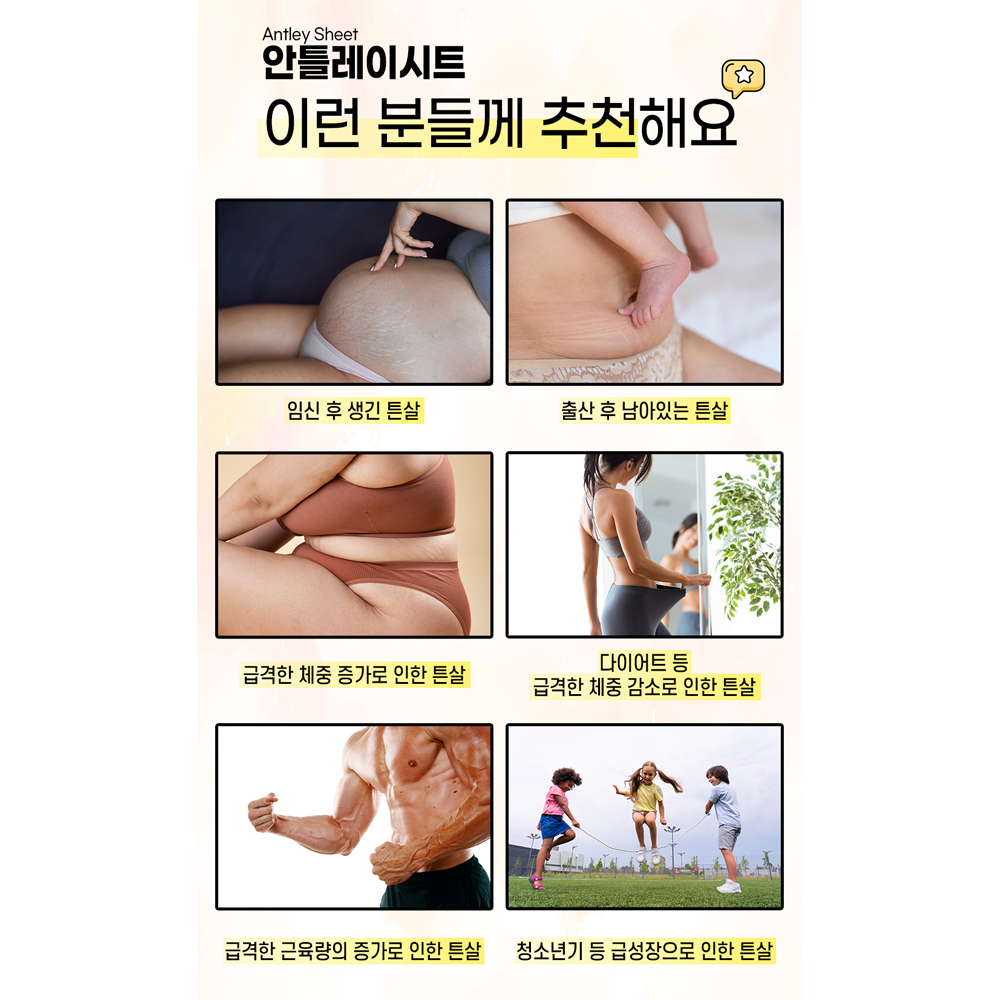 pH4 피에이치포 의료기기 안틀레이 붉은 튼살 제거 시트 15x12cm 임산부 청소년 엉덩이 배 의료기기 - 상세 이미지 4