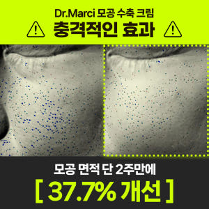 닥터마르시 피지 조절 크림 모공수축 54% 블랙헤드 나비존 오돌토돌 요철... 솔직 후기 | 피부 타입별 분석 - 상품 이미지 4